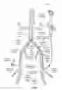 Fig. 07 - Modified fixed flat wire bifurcated catheter and its application in lower extremity interventions