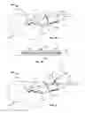 Fig. 07 - Systems and methods for anchoring medical devices