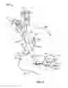 Fig. 12 - Systems and methods for anchoring medical devices