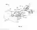 Fig. 14 - Systems and methods for anchoring medical devices