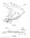 Fig. 15 - Systems and methods for anchoring medical devices