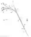 Fig. 02 - Rapid insertion integrated catheter and method of using an integrated catheter