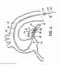 Fig. 04 - INTRAVASCULAR DELIVERY SYSTEM AND METHOD FOR PERCUTANEOUS CORONARY INTERVENTION