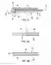 Fig. 08 - INTRAVASCULAR DELIVERY SYSTEM AND METHOD FOR PERCUTANEOUS CORONARY INTERVENTION
