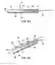 Fig. 09 - INTRAVASCULAR DELIVERY SYSTEM AND METHOD FOR PERCUTANEOUS CORONARY INTERVENTION