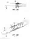 Fig. 22 - INTRAVASCULAR DELIVERY SYSTEM AND METHOD FOR PERCUTANEOUS CORONARY INTERVENTION