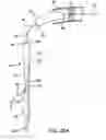 Fig. 32 - INTRAVASCULAR DELIVERY SYSTEM AND METHOD FOR PERCUTANEOUS CORONARY INTERVENTION