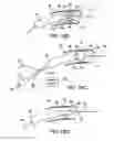 Fig. 33 - INTRAVASCULAR DELIVERY SYSTEM AND METHOD FOR PERCUTANEOUS CORONARY INTERVENTION