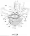 Fig. 03 - HIGH FREQUENCY MODULATION OF SACRAL NERVES TO ADDRESS PELVIC PAIN AND GASTROUROGENITAL CONDITIONS, AND ASSOCIATED SYSTEMS AND METHODS