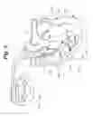 Fig. 04 - Cardiac stimulation apparatus and method for the control of hypertension