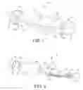 Fig. 02 - Sealed implantable medical device and method of forming same