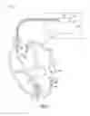 Fig. 02 - WIRELESS TISSUE ELECTROSTIMULATION