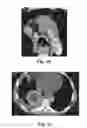 Fig. 06 - Method and System for Irradiating a Patient's Tumor
