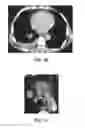 Fig. 07 - Method and System for Treatment of a Patient's Tumor
