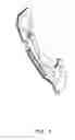 Fig. 07 - Multi function hand tool in a unitary device