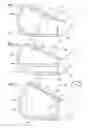 Fig. 04 - Striking face deflection structures in a golf club