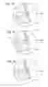 Fig. 08 - Striking face deflection structures in a golf club