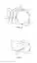 Fig. 06 - BROKEN NIPPLE EXTRACTOR WRENCH