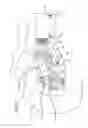Fig. 03 - Rod-end suspension arm