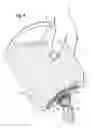 Fig. 04 - Fitment with propylene-based blend component and flexible container with same