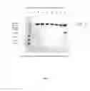 Fig. 07 - Use of a polymeric mesh for the purification of macromolecules