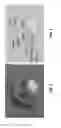Fig. 09 - METHODS OF ELECTROCHEMICAL DEPOSITION