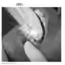 Fig. 01 - Methods and apparatuses for forming a three-dimensional volumetric model of a subject's teeth