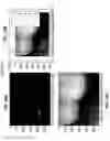 Fig. 22 - Methods and apparatuses for forming a three-dimensional volumetric model of a subject's teeth