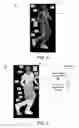 Fig. 04 - Method and apparatus for person super resolution from low resolution image