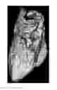 Fig. 01 - System and method for image segmentation