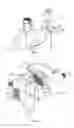 Fig. 02 - Module connectors for infusion pump systems