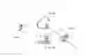 Fig. 09 - Mounting assembly for a bone conduction hearing device
