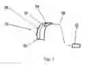 Fig. 02 - Method and apparatus for controlling a hearing instrument to relieve tinitus, hyperacusis, and hearing loss