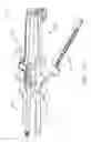 Fig. 32 - Staple cartridge for us with a surgical instrument