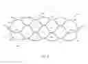 Fig. 02 - OCCLUSIVE MEDICAL DEVICE WITH SPLIT COLLAR