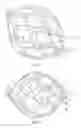 Fig. 04 - NOVEL ENHANCED ORB-LIKE INTRASACULAR DEVICE