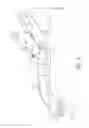 Fig. 03 - Pericardial devices, systems and methods for occluding an atrial appendage