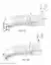 Fig. 10 - Pericardial devices, systems and methods for occluding an atrial appendage