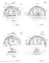 Fig. 07 - MILLING TOOL FOR PROSTHETIC SURGERY OPERATIONS