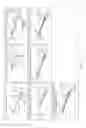 Fig. 04 - Surgical instrument