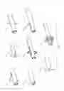 Fig. 08 - Surgical instrument