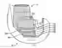 Fig. 01 - Void filling joint prosthesis and associated instruments