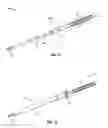 Fig. 07 - Void filling joint prosthesis and associated instruments