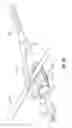 Fig. 10 - Void filling joint prosthesis and associated instruments
