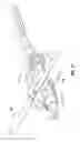 Fig. 11 - Void filling joint prosthesis and associated instruments