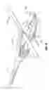 Fig. 13 - Void filling joint prosthesis and associated instruments