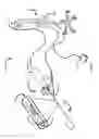 Fig. 02 - Linearly actuatable catheters, systems, and methods