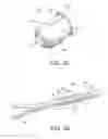 Fig. 03 - Steerable medical device