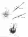 Fig. 07 - Steerable medical device