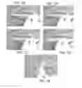 Fig. 08 - Steerable medical device